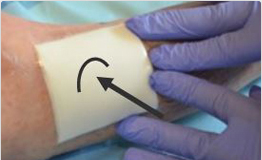 Healing with zinc oxide - a guide to the use of paste bandage